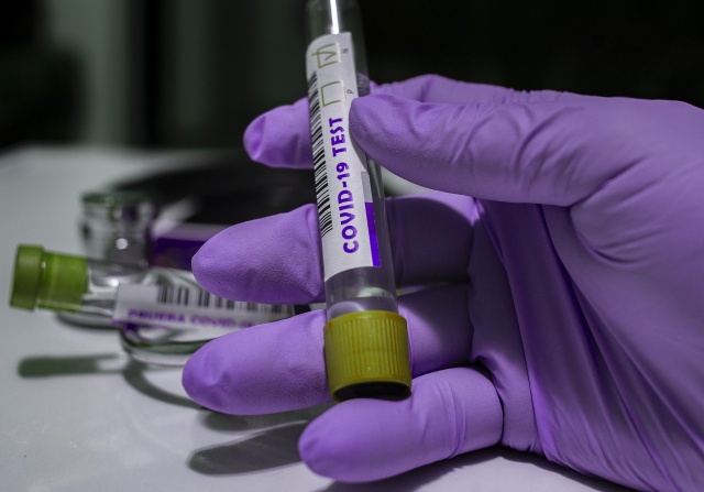 Raport dnia: 8 nowych przypadków koronawirusa na Opolszczyźnie. Chorobę pokonały dwie kolejne osoby