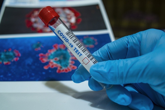 Ponad 15,5 tysiąca nowych przypadków koronawirusa w Polsce. W naszym regionie pozytywny wynik testu otrzymało 355 osób