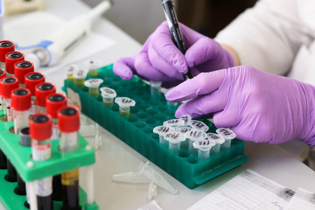 Spółka UNIMOT z Zawadzkiego sprowadzi 100 tysięcy testów na koronawirusa