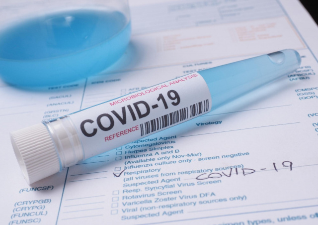 12 pacjentów z COVID-19 na oddziale zakaźnym w Opolu. Sytuacja w regionie jest stabilna