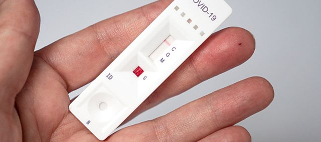 Pacjenci z objawami COVID-19 mogą zgłaszać się do lekarza POZ na bezpłatne testy antygenowe
