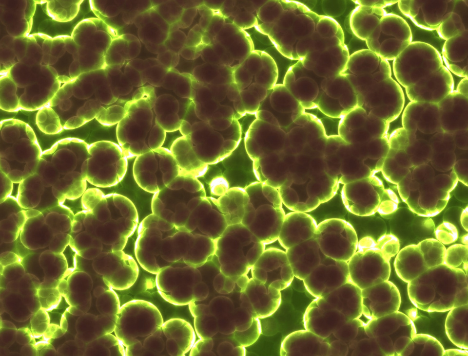 bakteria, zdjęcie poglądowe. [fot. Prawny z Pixabay.com]